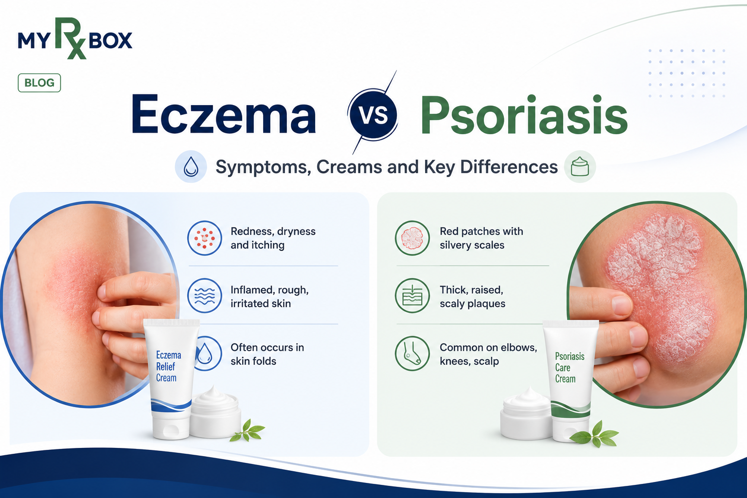 Eczema vs Psoriasis Symptoms, Creams and Key Differences